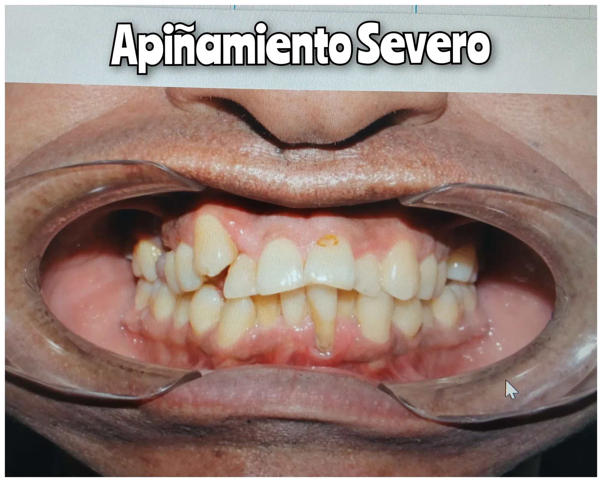 IVUq2NZo95gCp9ea_1000145436.webp