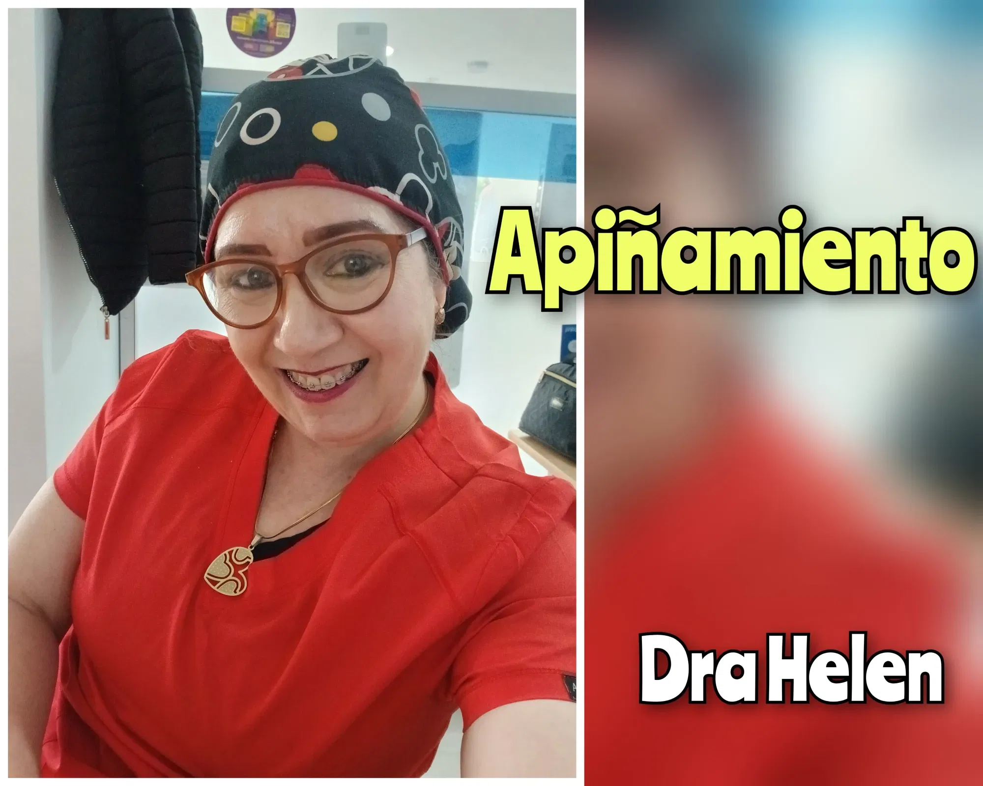 qBXBZI8…
Payout: 0.000 HBDApiñamiento Dental
2025-09-13 00:47<liketuimages> <center> ![R0BlVW7iUuVY5zhs_1000145435.webp