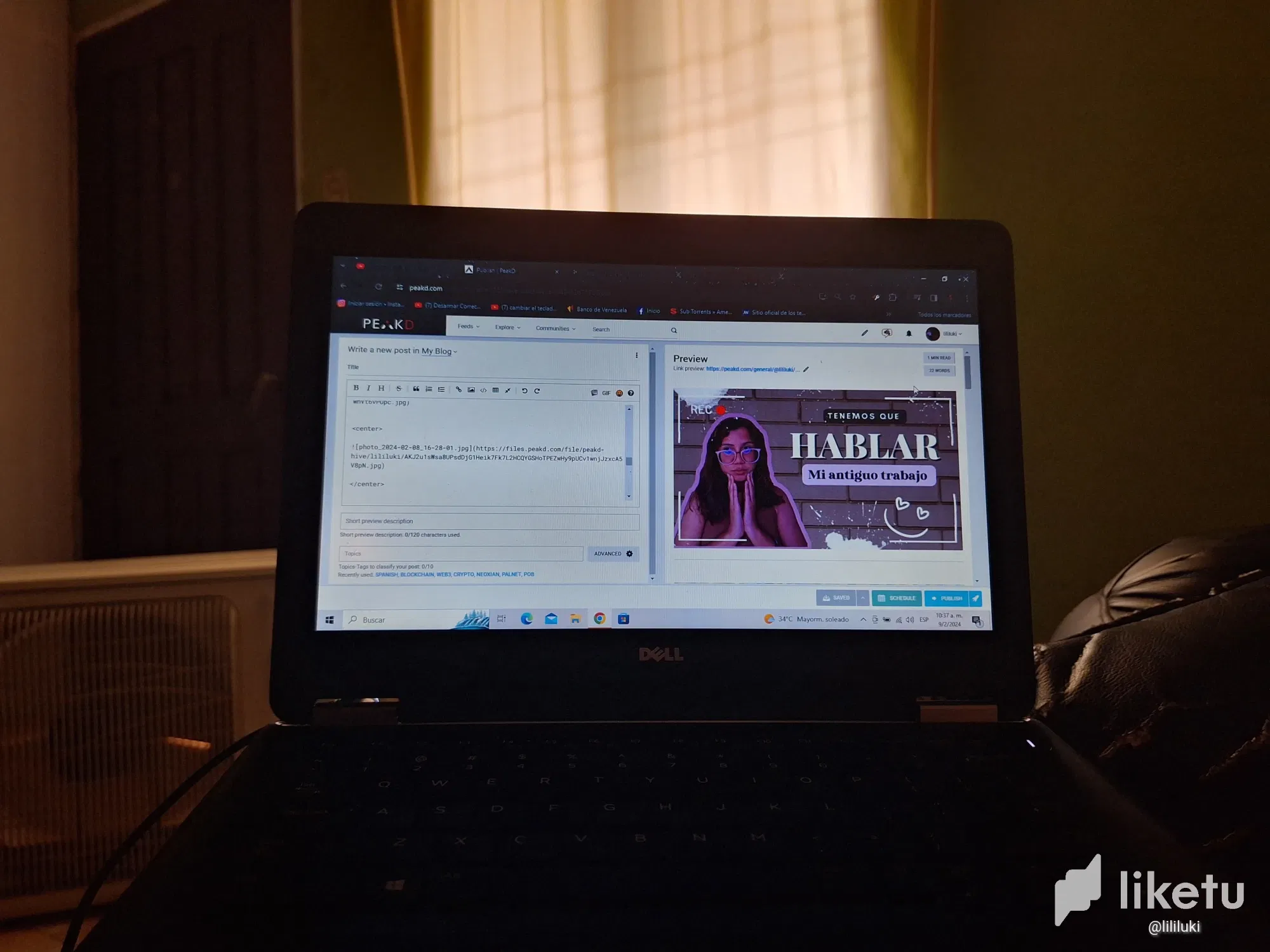 clserb2d6000varszeezw38q1_20240209_103708.webp