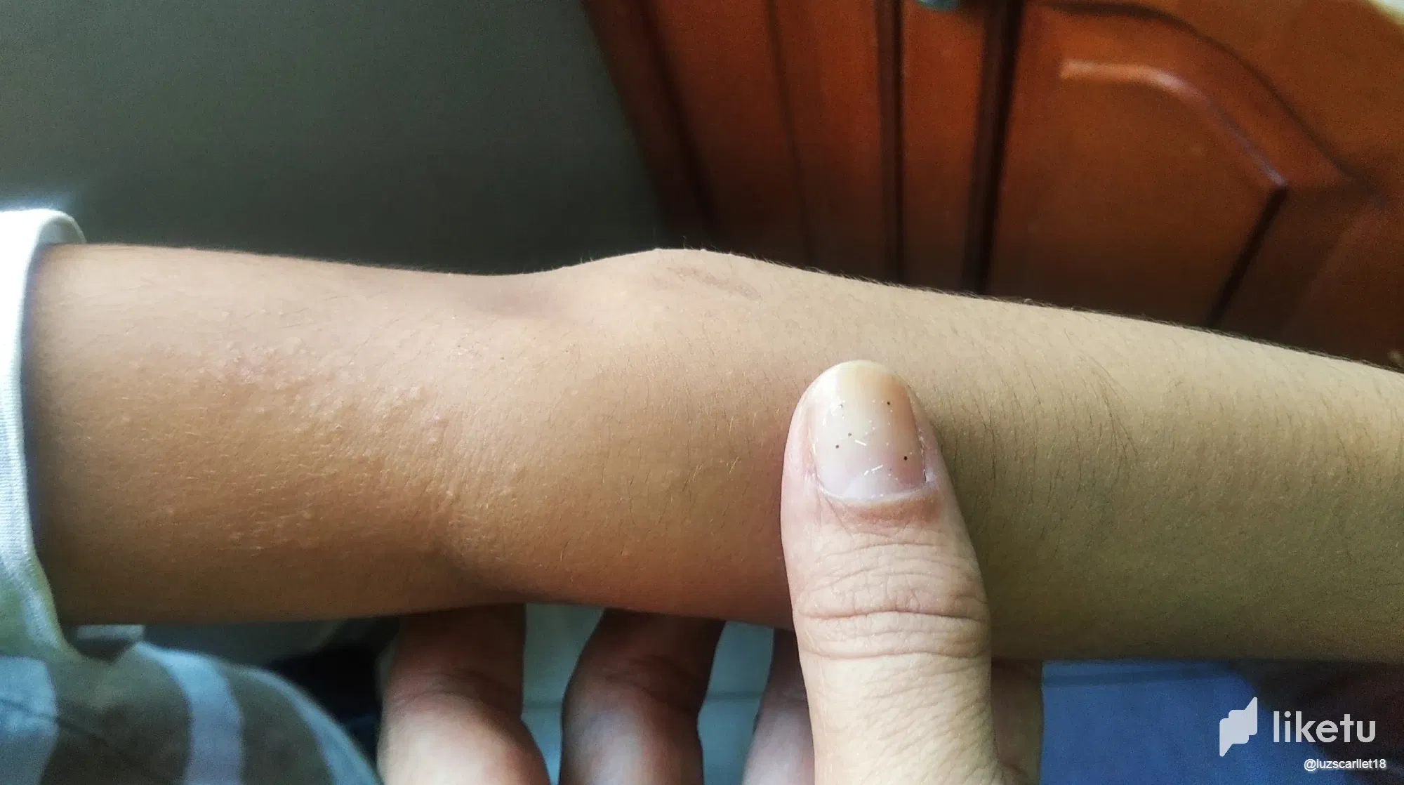 23mx09DWitrr1YPI_brazo.webp
