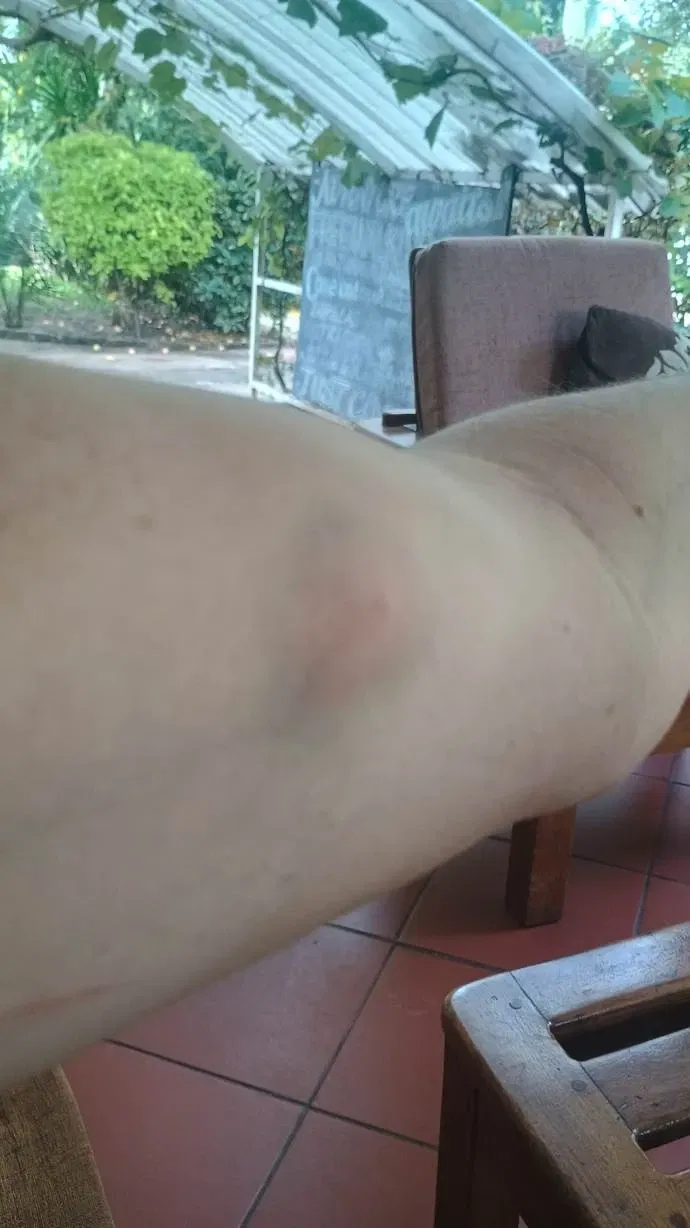 🌙 African Night… and One Very Dramatic Mosquito