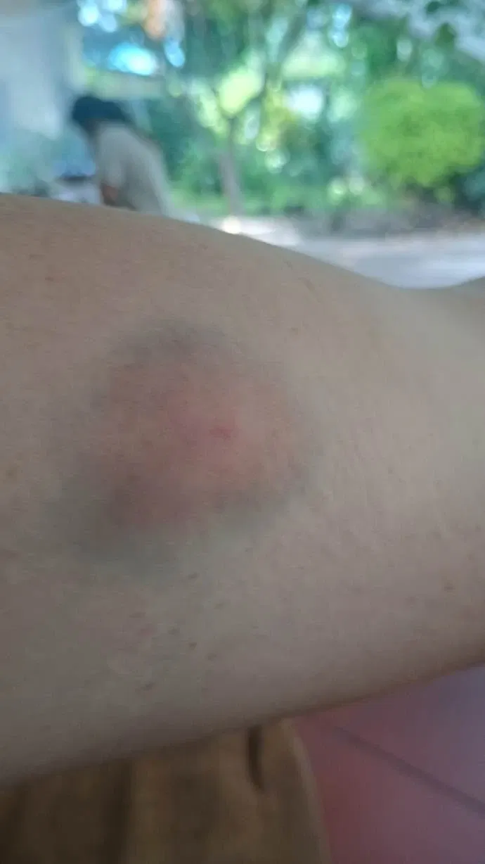 🌙 African Night… and One Very Dramatic Mosquito