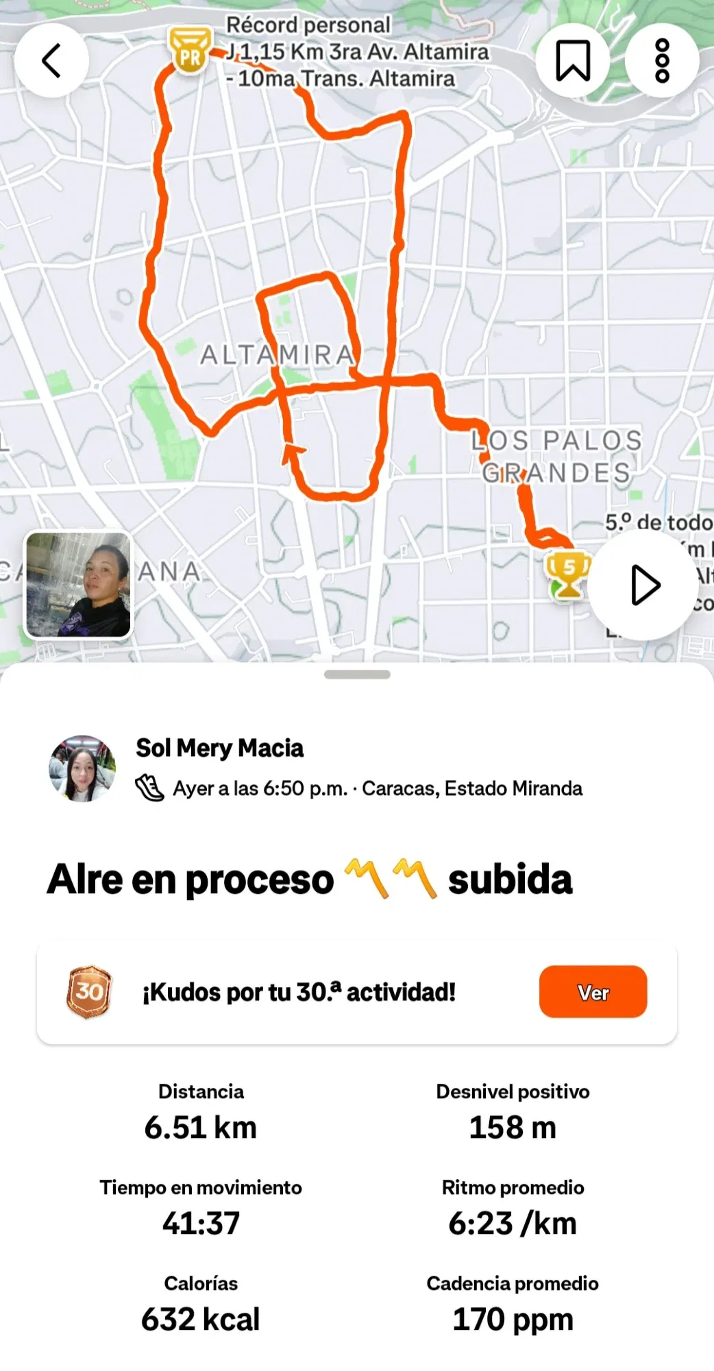 m8znj4MA…
Payout: 0.000 HBDEntrenamiento Alre 🔥
2025-10-26 14:32<liketuimages> <center> ![wD2IWgiQ2T7e9okI_1001002217.webp
